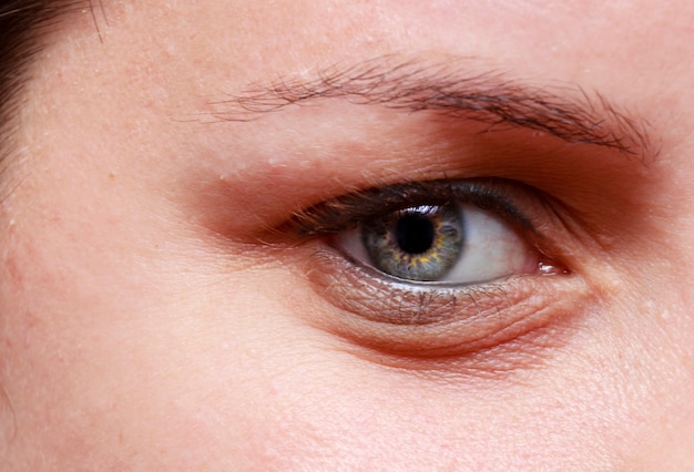 Close up on face of Caucasian woman with clear eyes