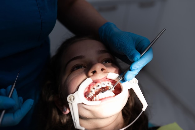 Close up of girl with brackets receiving dental braces treatment in clinic