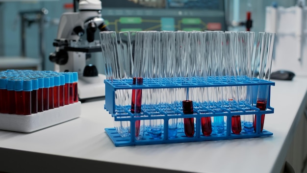 Close up of laboratory test tubes with blood on desk at workplace. Glass flasks filled with red substance or liquid placed on chemical tray. Vacutainers and microscope used in microbiology