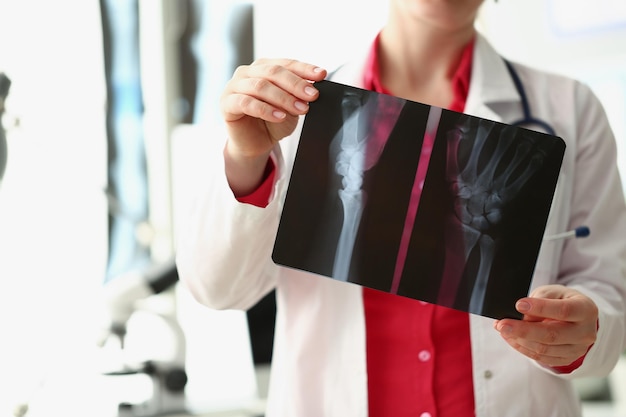 Close-up of medical worker analyzing patient hand xray result, injury. Specialist in uniform examine patient scan, prepare conclusion. Healthcare concept