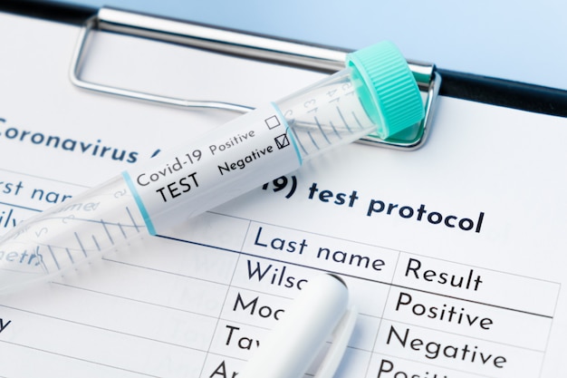 Photo close up negative covid-19 test tube and medical test protocol.