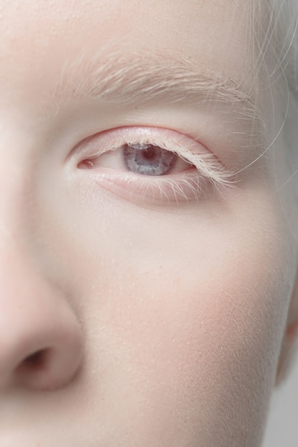 Close up portrait of beautiful albino woman isolated on studio background. . Details.