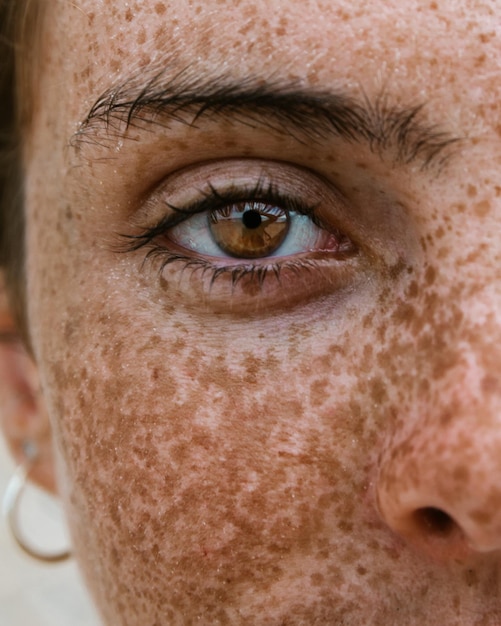 Close-up portrait of woman with freckles