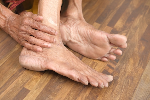 Close up on senior women feet and hand massage on injury spot