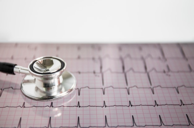 Photo close-up of stethoscope on heart beats cardiogram