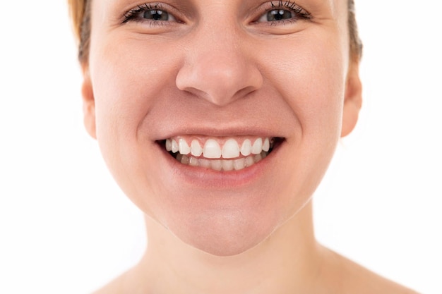 close-up of young woman smile with teeth.