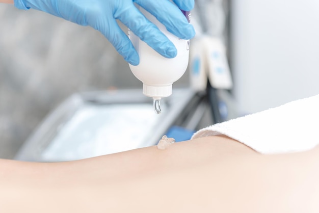 Closeup of a beautician applying laser hair removal gel to a clients legs