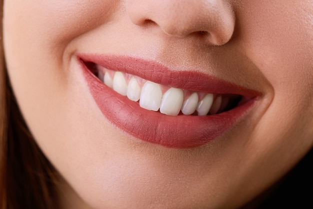 Closeup Beautiful young woman smile. Dental health. Teeth whitening.  Restoration concept