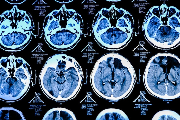 Photo closeup of ct scan with brain medicine science and education mri brain background