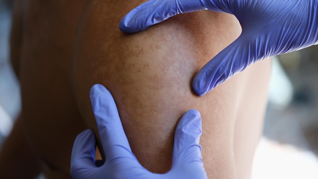 Photo closeup of dermatologist examining patients skin pigmentation in medical clinic doctor looks at