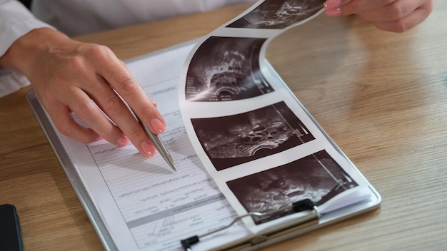 Closeup of doctor filling out medical paperwork ultrasound scan results and doctors hands with