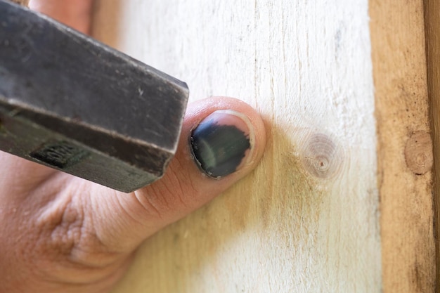 A closeup of an employee missed with a hammer and hit his finger Bruise hematoma injury Workplace injury A clumsy worker Selective focus