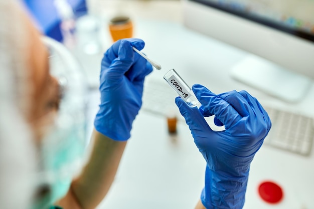 Closeup of epidemiologist analyzing COVID19 sample while working in a laboratory