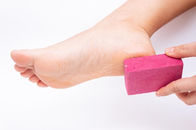 Closeup of a female foot with peeling skin on a heel A young woman scrubs foot with a pumice stone