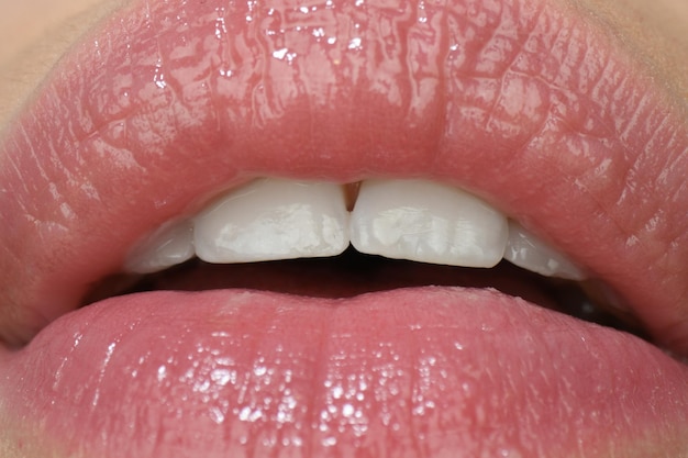 Closeup female mouth with soft pink natural lips and white clean perfect healthy teeth