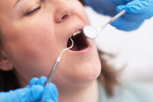 A closeup of a female teeth during a dental checkup tooth whitening treatment veneers services