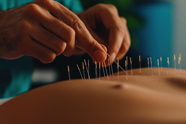 Photo closeup of hands performing acupuncture on skin showcasing fine needles for holistic therapy and relaxation