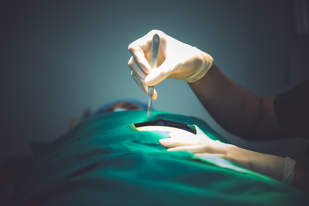 Closeup images Doctor's hand Holding a scalpel and performing surgery on the patient's abdomen