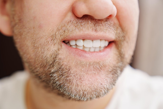 Closeup the man39s mouth with stubble smiles and shows white teeth