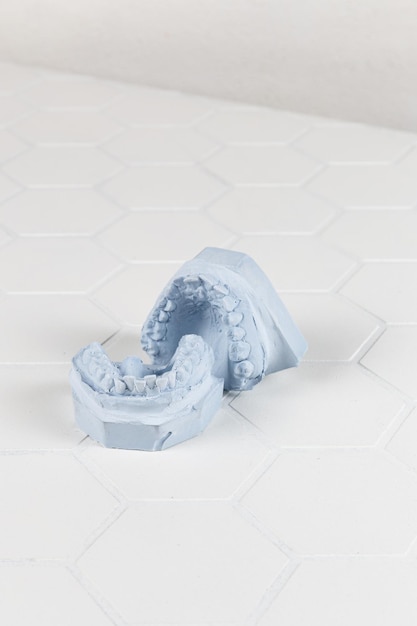 Closeup of a modern model of human jaws on a light white background crooked teeth