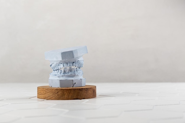 Closeup of a modern model of human jaws on a light white background crooked teeth