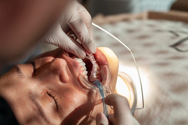 Closeup of an orthodontic specialist adjusting and placing invisible aligners on a Latina woman