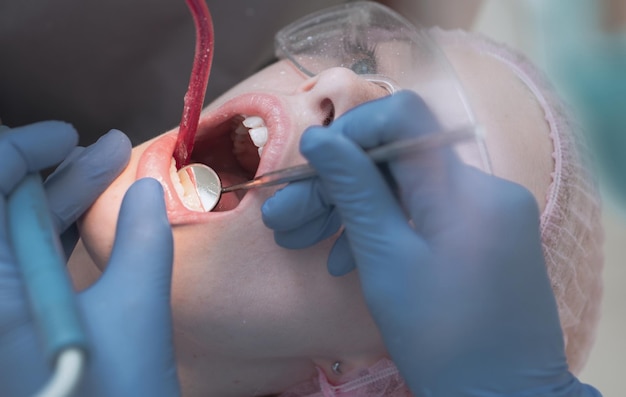 Closeup portrait of a female patient at dentist in the clinic There are specialized equipment to treat all types of dental diseases in the office