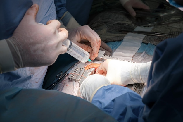 Closeup of professional doctor hands operating a patient during open heart surgery in surgical room Healthcare and medical intervention concept