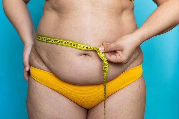 Closeup of unrecognizable plump woman stand in yellow swimming trunks showing naked belly measuring waist with tape