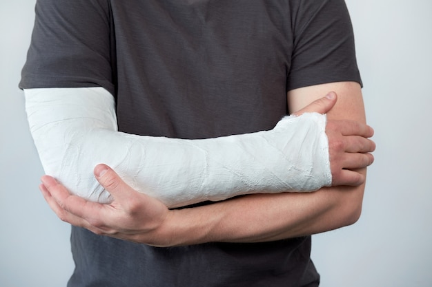 Closeup view of man's arm with plaster cast on a white wall