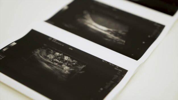 Photo collection of images from ultrasound scan examination action close up of monochrome images of