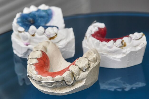 Colorful dental braces or retainers for teeth on glass wall