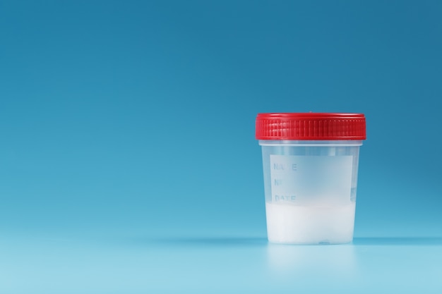 Container with medical tests of semen