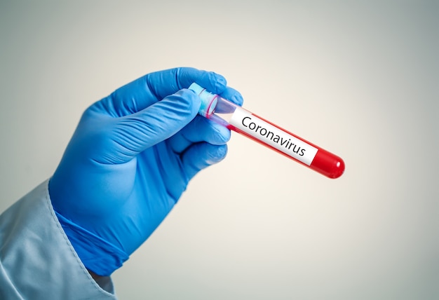 Corona Virus in Lab. Scientist hold Blood Test. New Epidemic Coronavirus 2019 nCoV. Background with copy space. Horizontal.