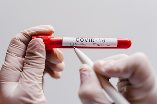 Coronavirus. A hands of doctor, nurse writing a note with a pen, holds tube containing a patient blood sample at laboratory.