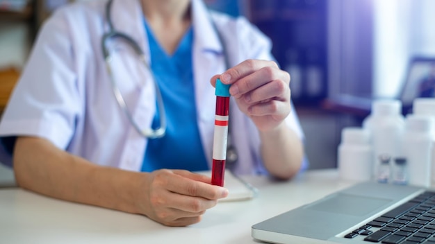 Coronavirus testing The doctor holds in his hand a test tube with a blood sample with a positive result xA