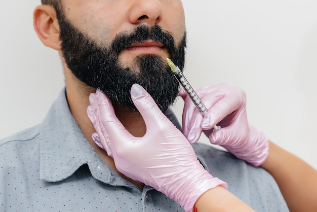 Cosmetic procedure for lip augmentation for a bearded man