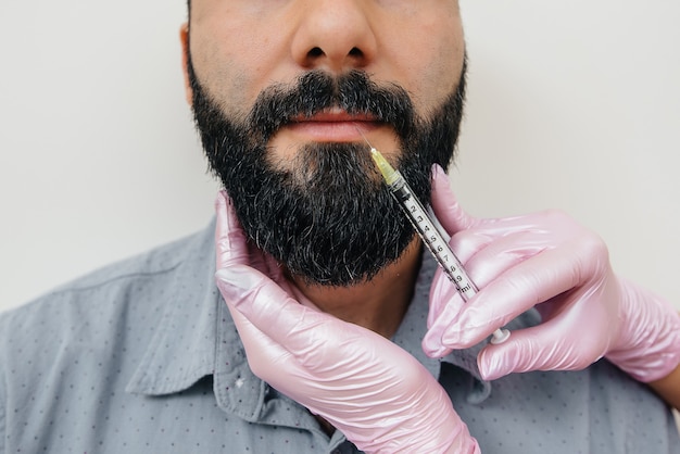 Cosmetic procedure for lip augmentation and wrinkle removal for a bearded man. Cosmetology.