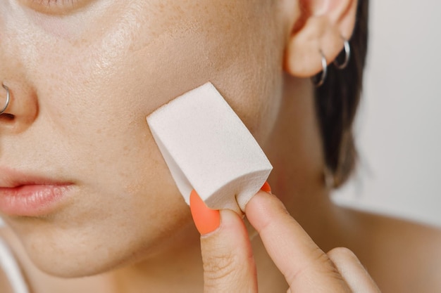 Cosmetics for acne, a woman girl applies a tonal foundation with a sponge to hide problems