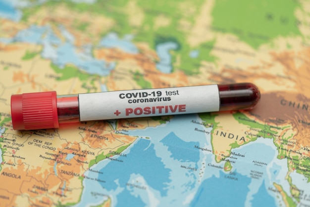 COVID 19 Coronavirus, infected blood sample in the sample tube, on world map, spread of disease, pandemic, Medicines business