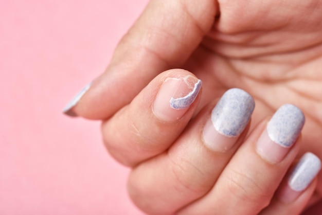 Cracked broken nail, Nail weakness damage from gel polish coating, Fingernail manicure hygiene.