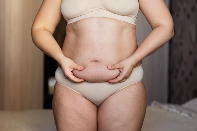 Cropped image of overweight woman tucking hiding fat naked big excessive abdomen with navel in underwear Dangling down tummy Drag away of abdomen Planning liposuction surgery cellulite problem