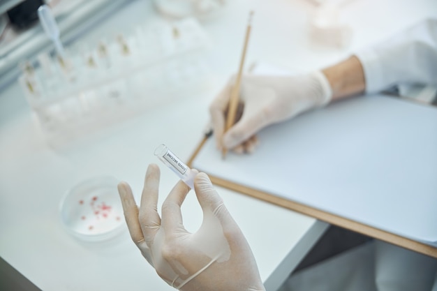 Cropped photo of a virologist with a covid vaccine in one hand writing on a blank sheet of paper