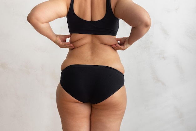 Cropped rearview of adipose overweight female body in black underwear checking and holding excess folds no collagen