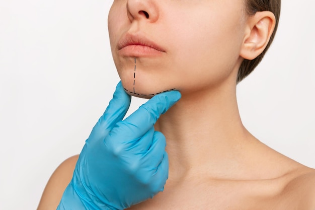 Cropped shot of a young caucasian woman with marking on her chin Facial plastic surgery