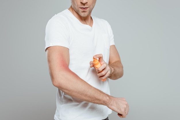 Cropped view of man applying sunscreen on hand with redness isolated on grey