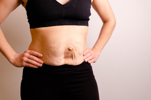 Cropped woman dressed in black top and black leggings diastasis and umbilical hernia after pregnancy