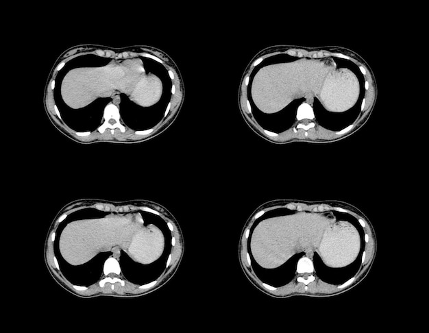 Ct Scan and MRI Abdomen professional images