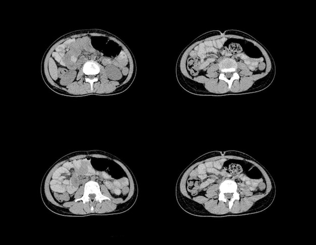 Ct Scan and MRI Abdomen professional images