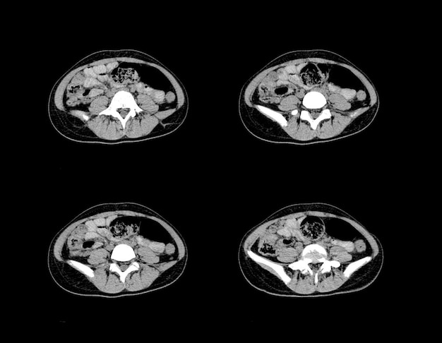 Ct Scan and MRI Abdomen professional images